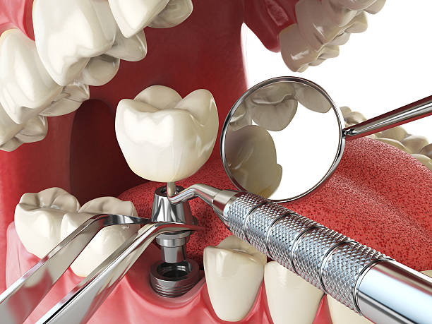 Best Same-Day Emergency Dental Services in Timberne, LA