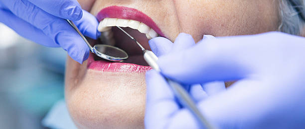 Best Same-Day Emergency Dental Services in Timberne, LA